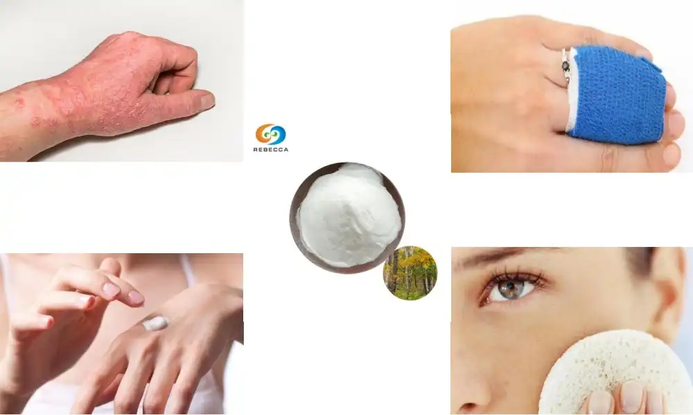 Soothe Irritated Skin Naturally with Birch Bark Extract